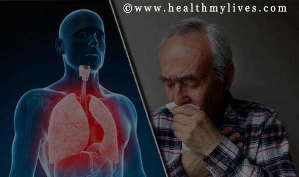symptoms of COPD