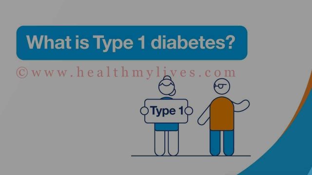 type 1 diabetes