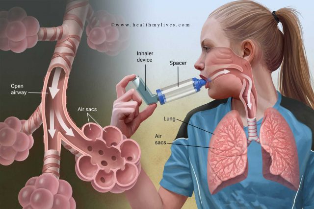 asthma prevention
