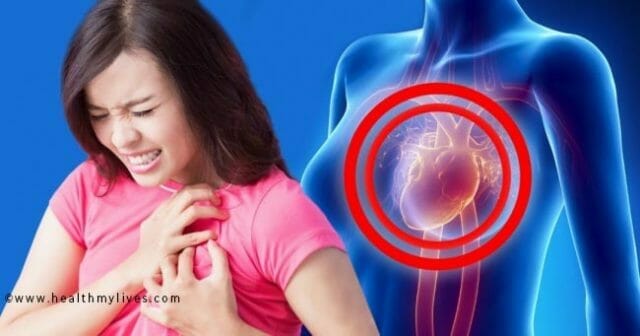 heart attack treatment