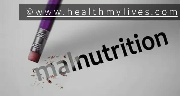 Malnutrition Prevention