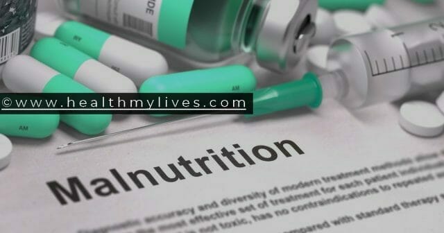 Malnutrition Symptoms