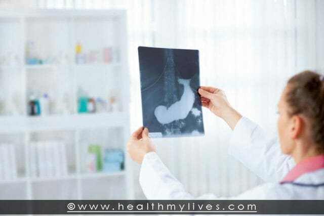 Pancreatitis Treatment