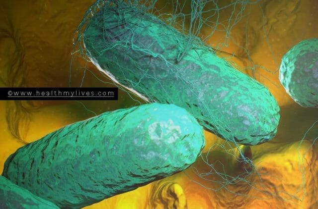 Salmonella Typhi